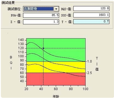 草莓视频入口仪的专业厂家阐述骨质增生与骨质疏松,仪器专业检测草莓视频入口正常值